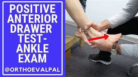 ankle ligament tear test|positive anterior drawer test ankle.